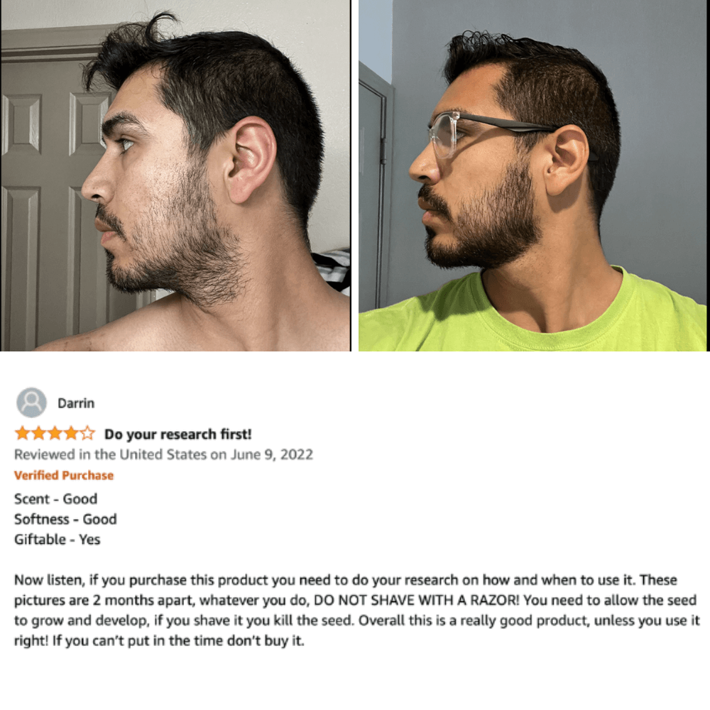 derma beard roller before and after